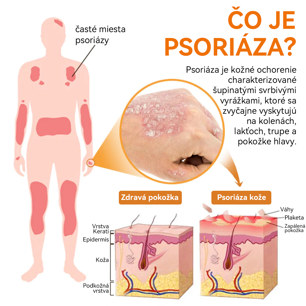 𝐎𝐘𝐈𝐊𝐄𝐘™ 𝐕č𝐞𝐥í 𝐣𝐞𝐝 𝐏𝐬𝐨𝐫𝐢á𝐳𝐚 𝐋𝐢𝐞č𝐛𝐚 𝐒𝐩𝐫𝐞𝐣 (🔥 60% z posledného dňa nákupu balíka 🔥)🏆