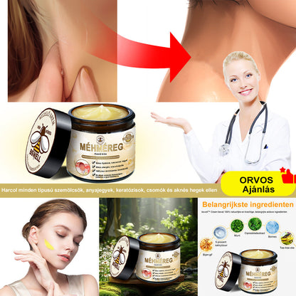 🐝BSWELL® Krém na ošetrenie včelím jedom👨‍⚕️（MDT recommended） (🔥Posledný deň akcie 80% zľava）