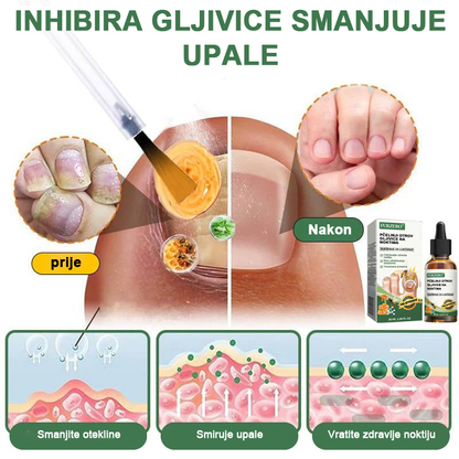 👩‍⚕️Furzero™ Ošetrujúce sérum proti včelímu jedu na nechty