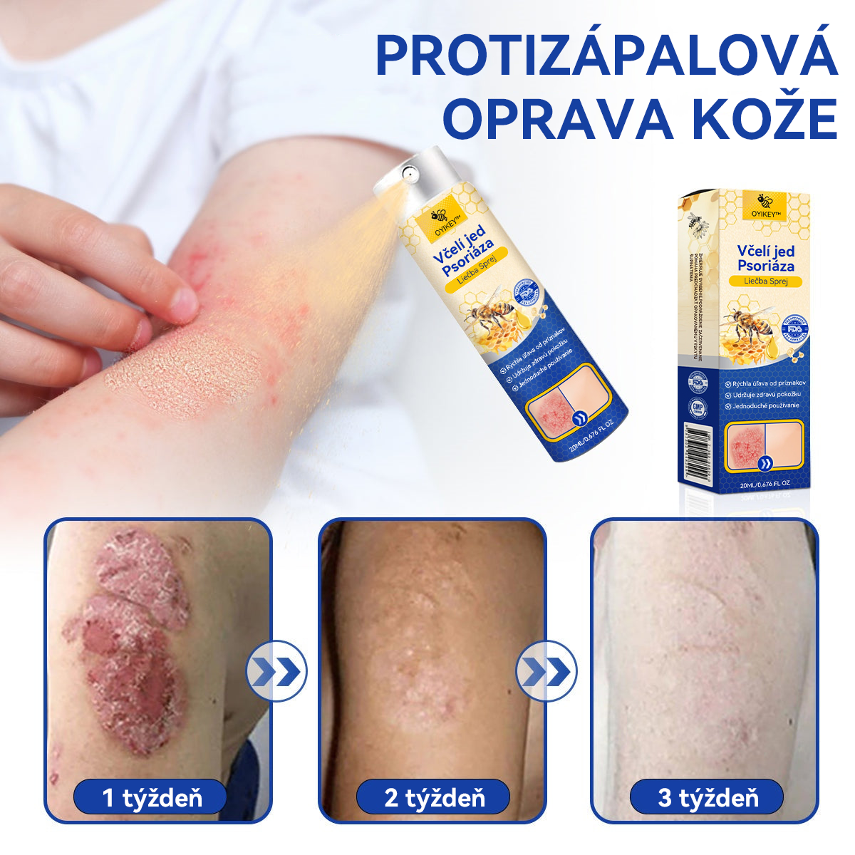 𝐎𝐘𝐈𝐊𝐄𝐘™ 𝐕č𝐞𝐥í 𝐣𝐞𝐝 𝐏𝐬𝐨𝐫𝐢á𝐳𝐚 𝐋𝐢𝐞č𝐛𝐚 𝐒𝐩𝐫𝐞𝐣 (🔥 60% z posledného dňa nákupu balíka 🔥)🏆