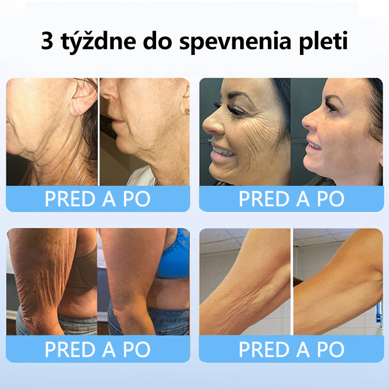 Flysmus™ Kolagénové peptidy SPEVŇUJÚCE SÉRUM v tyčinke  🇸🇰 Certifikované Slovenským ústavom hygieny (SÚH) a Slovenskou dermatologickou spoločnosťou (SDS), zaručujúce najvyššiu kvalitu a bezpečnosť pre vašu pleť.