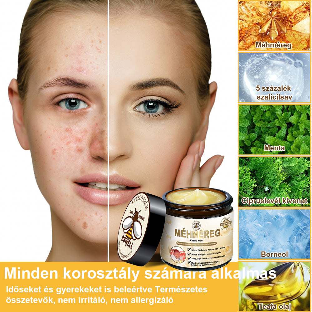 🐝BSWELL® Krém na ošetrenie včelím jedom👨‍⚕️（MDT recommended） (🔥Posledný deň akcie 80% zľava）