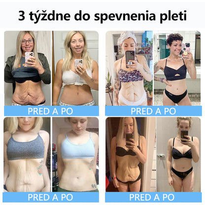 Flysmus™ Kolagénové peptidy SPEVŇUJÚCE SÉRUM v tyčinke  🇸🇰 Certifikované Slovenským ústavom hygieny (SÚH) a Slovenskou dermatologickou spoločnosťou (SDS), zaručujúce najvyššiu kvalitu a bezpečnosť pre vašu pleť.
