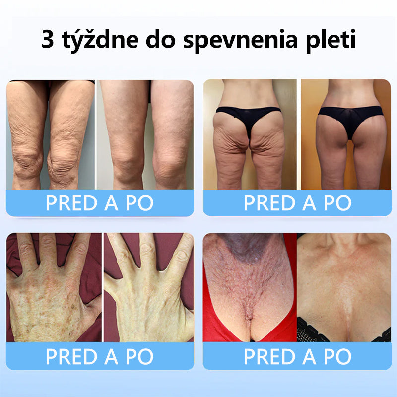 Flysmus™ Kolagénové peptidy SPEVŇUJÚCE SÉRUM v tyčinke  🇸🇰 Certifikované Slovenským ústavom hygieny (SÚH) a Slovenskou dermatologickou spoločnosťou (SDS), zaručujúce najvyššiu kvalitu a bezpečnosť pre vašu pleť.