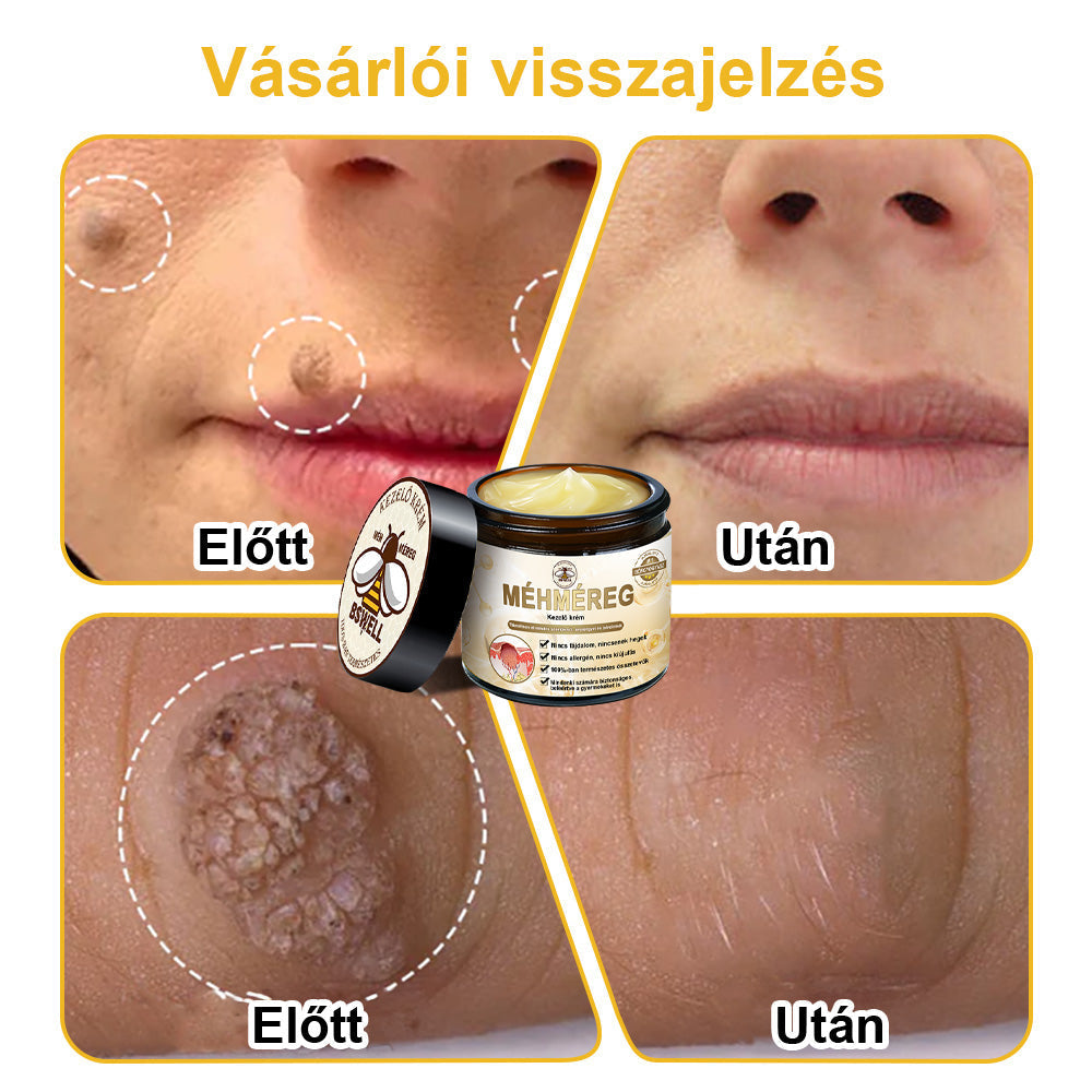 🐝BSWELL® Krém na ošetrenie včelím jedom👨‍⚕️（MDT recommended） (🔥Posledný deň akcie 80% zľava）