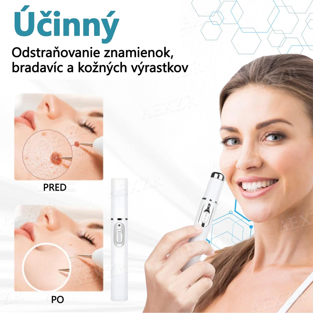 Bikenda® Neinvazívne laserové pero na odstránenie znamienok a bradavíc