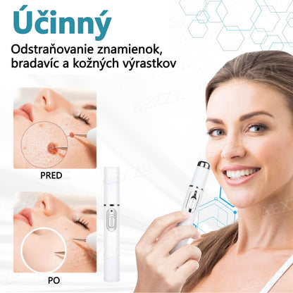 Bikenda® Neinvazívne laserové pero na odstránenie znamienok a bradavíc