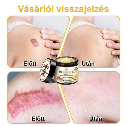 🐝BSWELL® Krém na ošetrenie včelím jedom👨‍⚕️（MDT recommended） (🔥Posledný deň akcie 80% zľava）