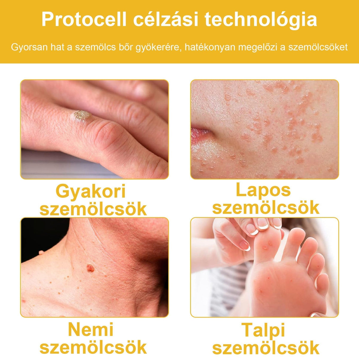 🐝BSWELL® Krém na ošetrenie včelím jedom👨‍⚕️（MDT recommended） (🔥Posledný deň akcie 80% zľava）