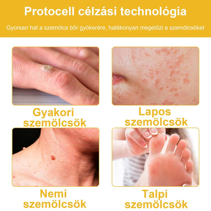 🐝BSWELL® Krém na ošetrenie včelím jedom👨‍⚕️（MDT recommended） (🔥Posledný deň akcie 80% zľava）