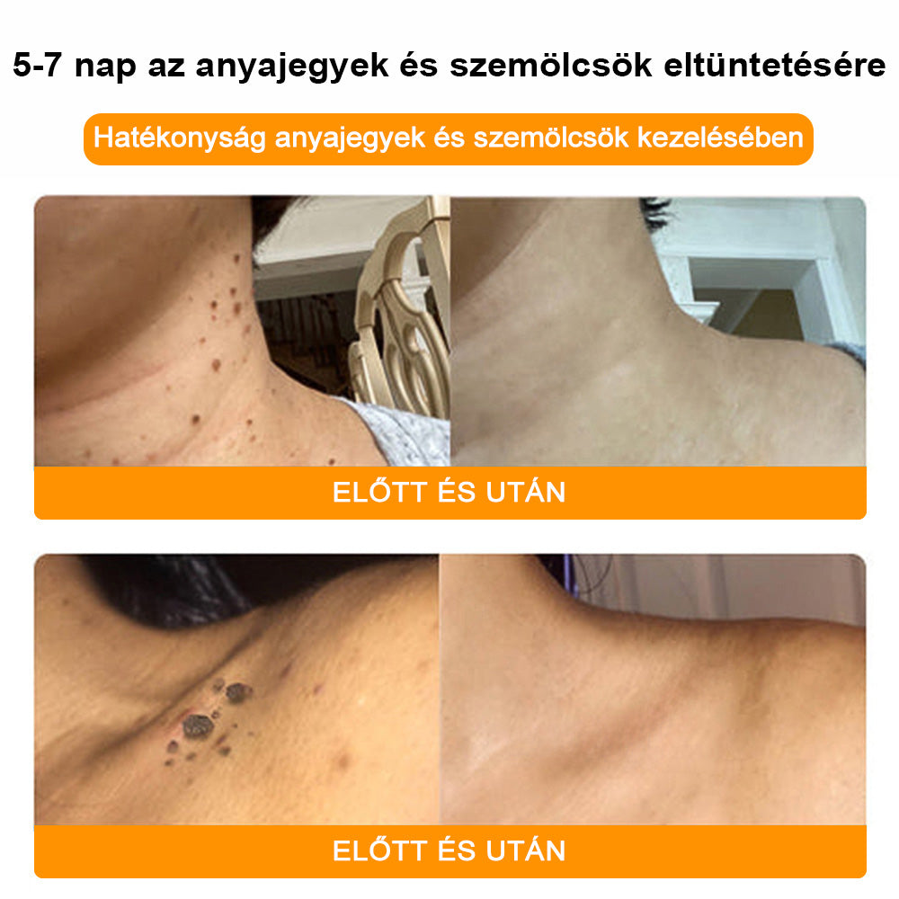🐝BSWELL® Krém na ošetrenie včelím jedom👨‍⚕️（MDT recommended） (🔥Posledný deň akcie 80% zľava）