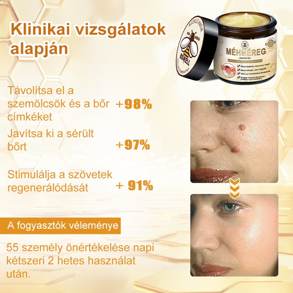 🐝BSWELL® Krém na ošetrenie včelím jedom👨‍⚕️（MDT recommended） (🔥Posledný deň akcie 80% zľava）