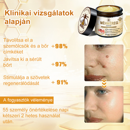 🐝BSWELL® Krém na ošetrenie včelím jedom👨‍⚕️（MDT recommended） (🔥Posledný deň akcie 80% zľava）