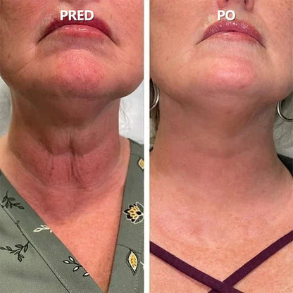 🎉🎉 Posledný deň akcie 70% zľava - Fubsta™ Omladzujúce sérum SkinFirming