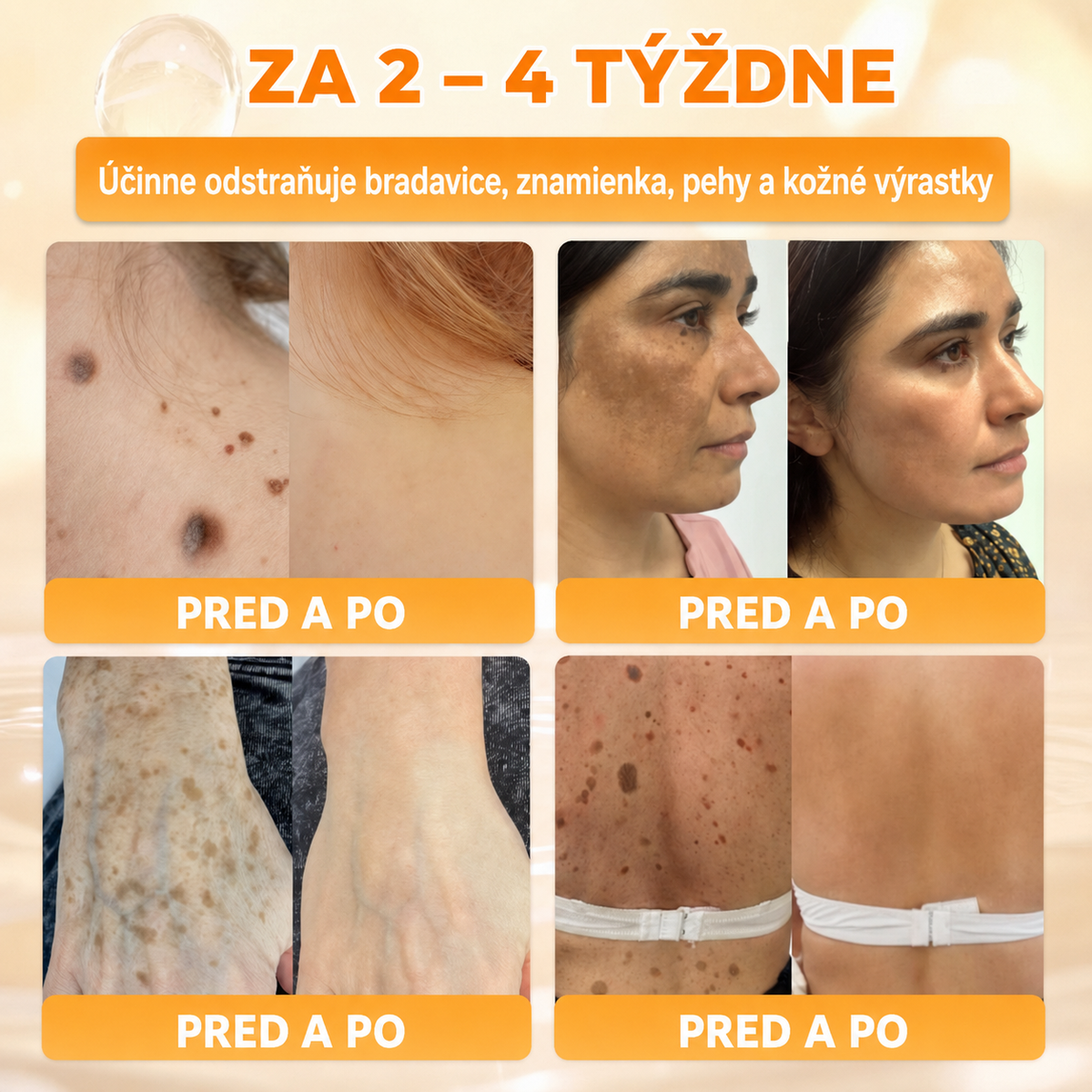 🔥🔥𝗢𝗳𝗶𝗰𝗶á𝗹𝗻𝘆 𝗼𝗯𝗰𝗵𝗼𝗱 • 𝗩𝘆𝗿𝗼𝗯𝗲𝗻é 𝗻𝗮 𝗦𝗹𝗼𝘃𝗲𝗻𝘀𝗸𝘂🌱𝗗𝐨𝐫𝗺𝐨𝐫𝗻𝗮® 𝗞𝗼𝗺𝗽𝗹𝗲𝘅𝗻ý 𝗸𝗿é𝗺 𝘀 𝘃č𝗲𝗹í𝗺 𝗷𝗲𝗱𝗼𝗺🌟𝐏𝐎𝐒𝐋𝐄𝐃𝐍Ý 𝐃𝐄Ň – 𝟖𝟎 % 𝐙Ľ𝐀𝐕𝐀