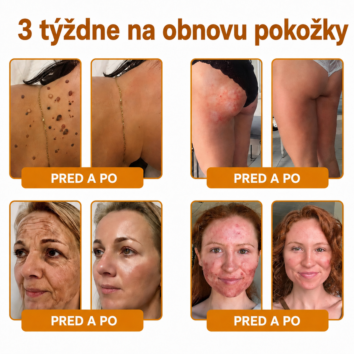 🔥🔥𝗢𝗳𝗶𝗰𝗶á𝗹𝗻𝘆 𝗼𝗯𝗰𝗵𝗼𝗱 • 𝗩𝘆𝗿𝗼𝗯𝗲𝗻é 𝗻𝗮 𝗦𝗹𝗼𝘃𝗲𝗻𝘀𝗸𝘂🌱𝗗𝐨𝐫𝗺𝐨𝐫𝗻𝗮® 𝗞𝗼𝗺𝗽𝗹𝗲𝘅𝗻ý 𝗸𝗿é𝗺 𝘀 𝘃č𝗲𝗹í𝗺 𝗷𝗲𝗱𝗼𝗺🌟𝐏𝐎𝐒𝐋𝐄𝐃𝐍Ý 𝐃𝐄Ň – 𝟖𝟎 % 𝐙Ľ𝐀𝐕𝐀